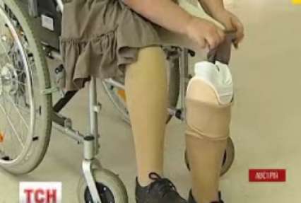 Волонтерка з України потребує коштів на протези ніг
