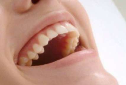 5 злейших врагов зубной эмали