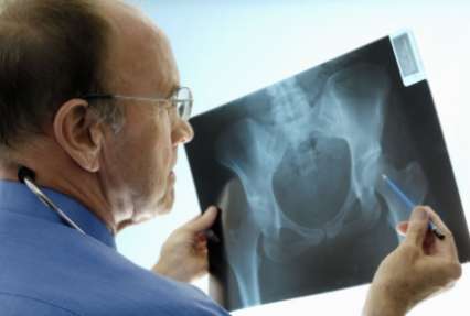 Рентген при дисплазии тазобедренных суставов