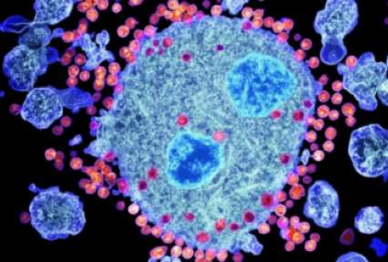 Экспериментальная иммунотерапия ВИЧ прошла первый этап испытаний безопасности